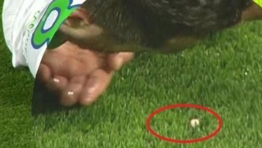 لاعب الوسط البرتغالي فارينها يتعرض لإصابة يفقد خلالها إحدى أسنانه