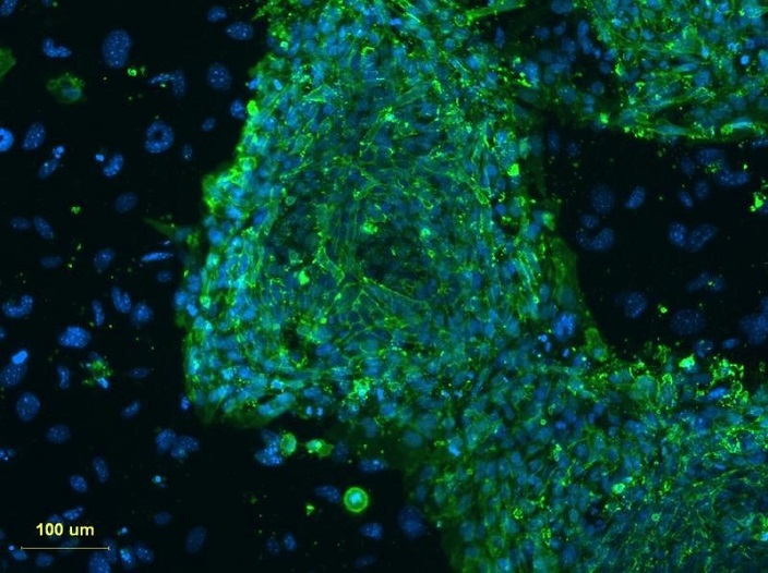 صورة مجهرية من أرشيف رويترز توضح خلايا جذعية من الحبل السري