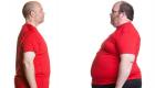 9 معلومات عن استخدام "البوتكس" في فقدان الوزن