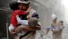  السعودية تتكفل بعلاج 150 طفلا من مصابي حلب