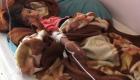 ظهور إصابات بالكوليرا في اليمن بحسب اليونيسيف