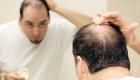إنفوجراف.. 6 أسباب تؤدي إلى تساقط شعر الرأس