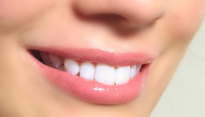 تجميل الأسنان .. 4 طرق للوصول إلى ابتسامة مثالية
