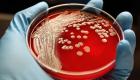التوصل لبكتيريا "مفترسة" تقتل الجراثيم المقاومة للمضادات الحيوية