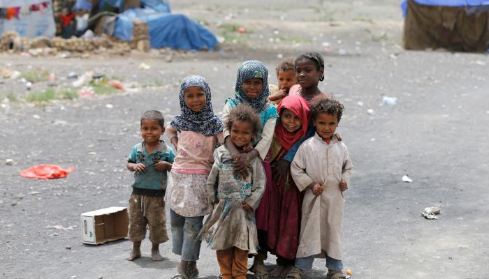 مقتل طفل يمني كل 10 دقائق بسبب سوء التغذية والأمراض