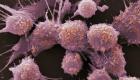 بكتيريا من قاع المحيط تقضي على سرطان البروستاتا