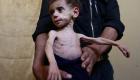 تنديد أممي بالوضع الإنساني"الصادم" في الغوطة الشرقية 