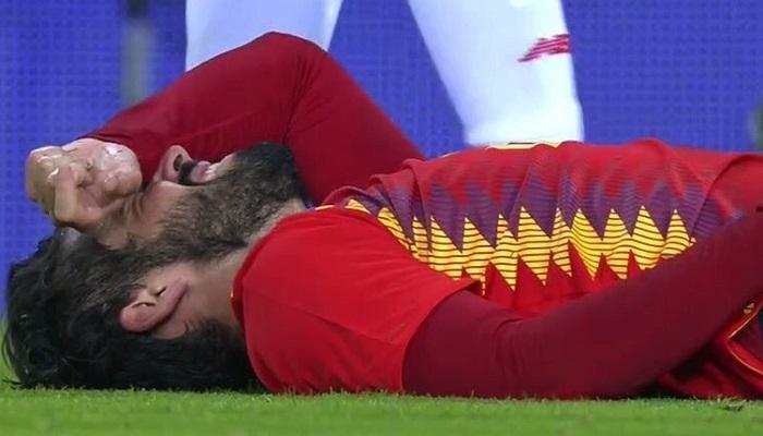 غموض موقف إيسكو من مواجهة روسيا