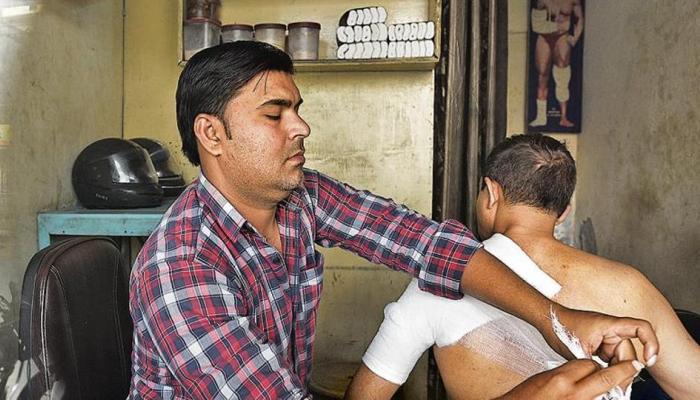 رجل في دلهي يرد العظام إلى مكانها