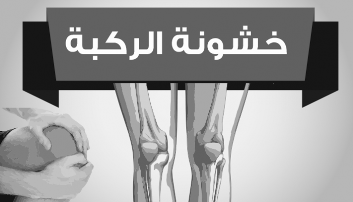 خشونة الركبة تسبب آلاما مبرحة