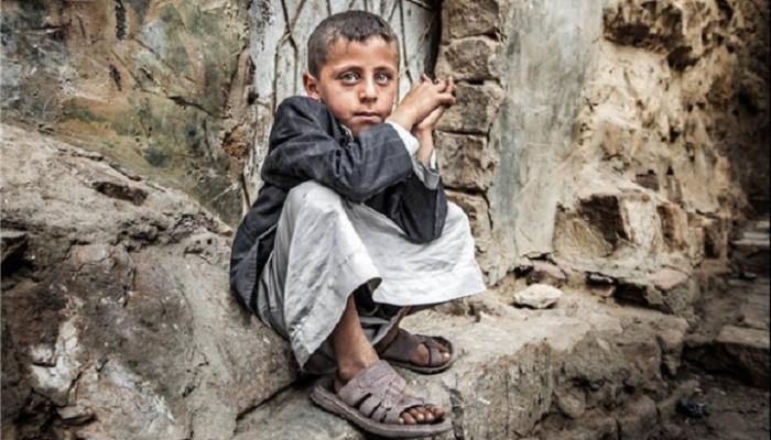 المجاعة تهدد سكان اليمن