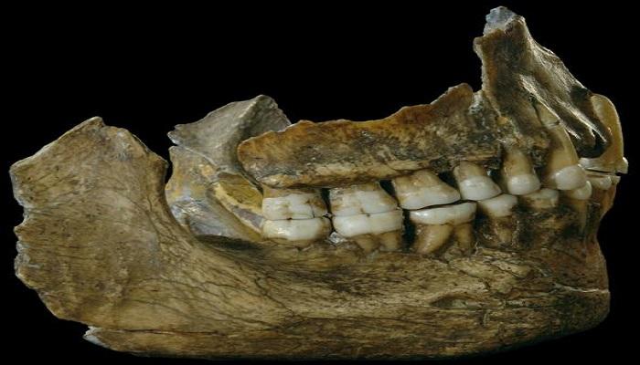 مفاجأة.. آثار "أسبرين" في أسنان الإنسان البدائي