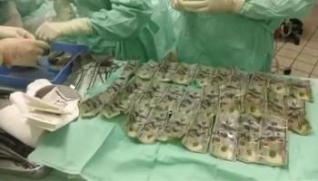 الأطباء نجحوا في إنقاذ 5700 دولار