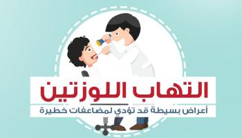 التهاب اللوزتين أعراض بسيطة قد تؤدي لمضاعفات خطيرة