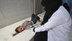 توقعات بارتفاع الإصابة بالكوليرا في اليمن إلى 300 ألف خلال 6 أشهر