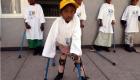 ظهور شلل الأطفال في الكونغو الديمقراطية