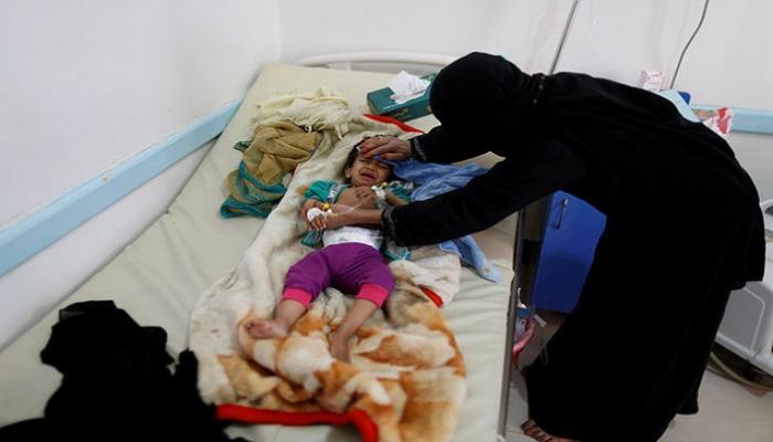 2 مليون طفل يمني يعانون من سوء التغذية