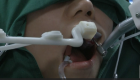 بالفيديو.. روبوت يجري أول جراحة أسنان دون تدخل بشري