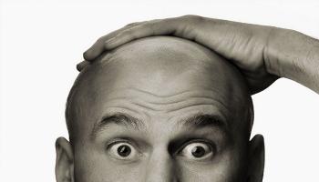 هندي ينتحر بسبب تساقط شعره 