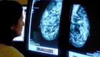 دراسة: 4 من كل 10 مصابين بالسرطان يتعرضون لتشخيص مبدئي خاطئ