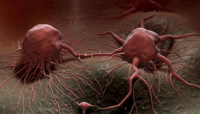 خلايا سرطانية - أرشيفية