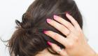4 طرق سهلة للتخلص من قشرة الشعر