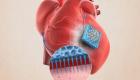 باحثون يطورون لاصقا طبيا لإعادة بناء أنسجة القلب