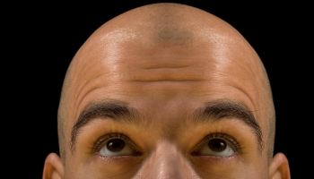 أول بنك للشعر لمحاربة الصلع