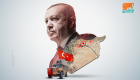 صحفي تركي: أردوغان يستغل عدوانه على سوريا لقمع المعارضين