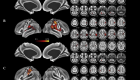 اكتشاف أسرار الخريطة العصبية للدماغ 