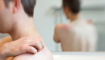 النخالة الوردية مرض جلدي غير ضار