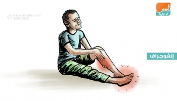 إنفوجراف عن تشنجات الأقدام المتكررة