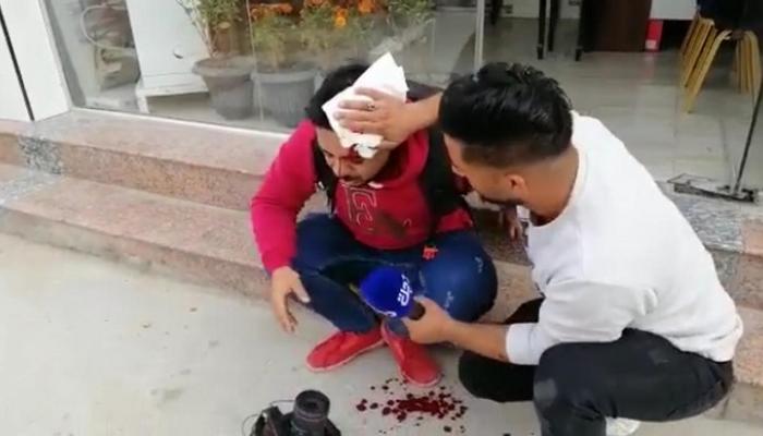 مصور عراقي مصاب إثر تعرضه للضرب من قبل المليشيات في محافظة السماوة