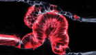 تصوير ثلاثي الأبعاد لسرطان البنكرياس يكشف لغز تشكل الأورام 