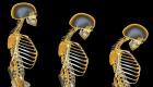 اكتشاف تقنية جديدة لإصلاح تشوهات العظام المعقدة