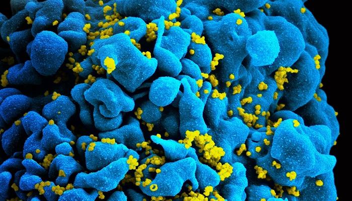 حكى مشاكل شجار  علاج مناعي للسرطان يقلل حجم مستودع فيروس الإيدز