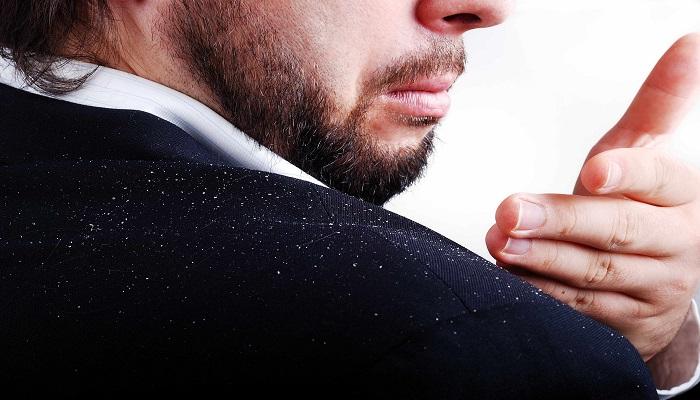 طرق طبيعية للتخلص من قشرة الشعر