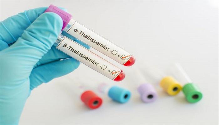 الإمارات تستضيف اجتماع الاتحاد الدولي للثلاسيميا 7 أبريل -صورة أرشيفية