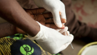 "الصحة العالمية": خلو الجزائر والأرجنتين من الملاريا