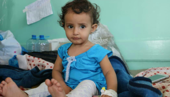 طفلة يمنية مصابة بالكوليرا