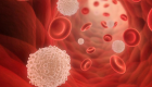 اكتشاف سر زيادة خلايا الدم البيضاء لدى مرضى الكوليسترول 