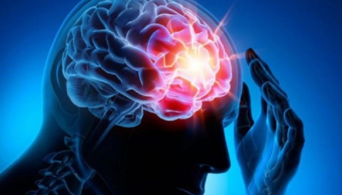 الكوليسترول المنخفض يزيد خطر الإصابة بالسكتة الدماغية