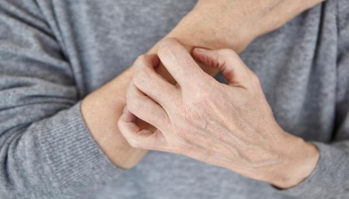 الحكة شعور غير مريح بالتهيج ويُولّد الرغبة بالهرش