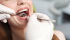 تركيبات الأسنان.. حل مثالي لعلاج تشوهات الفم