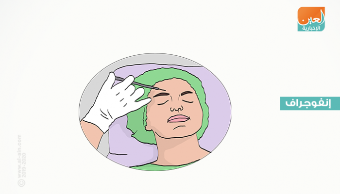 حقن