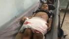 جريمة حوثية جديدة ضد أطفال تعز اليمنية