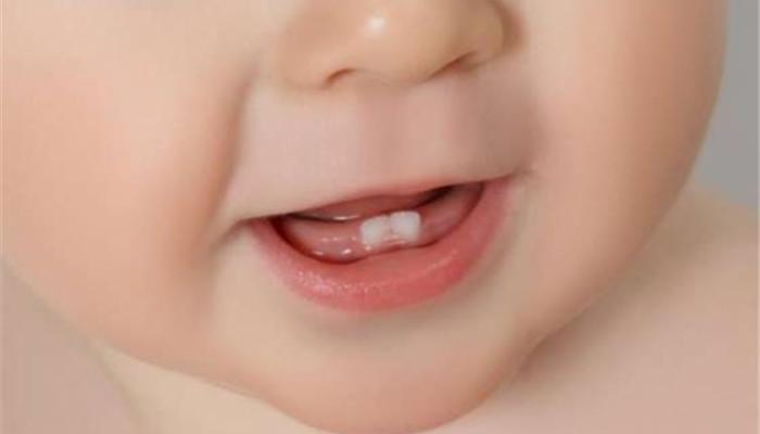 الحلويات تضر كثيراً بأسنان البراعم