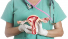 "الورم الليفي" قد يؤدي للإجهاض المتكرر