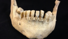 اكتشاف بروتين مصل اللبن في أسنان عمرها 6 آلاف عام
