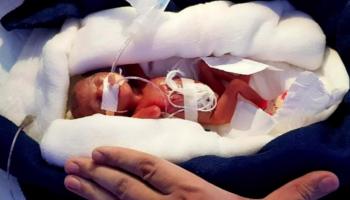 الرضيع الشفاف